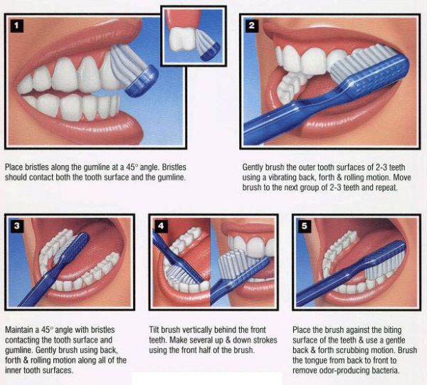 oral hygeine-correct-tooth-brushing