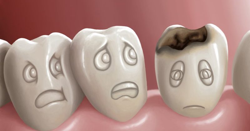 Πώς προλαμβάνεται η τερηδόνα και επανασβεστιώνεται η οδοντική επιφάνεια ;