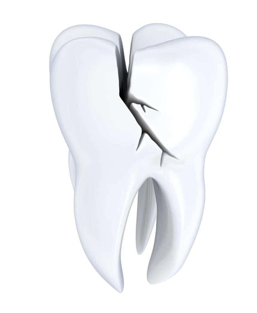 Πώς προλαμβάνονται οι οδοντικοί τραυματισμοί και πώς αντιμετωπίζονται;